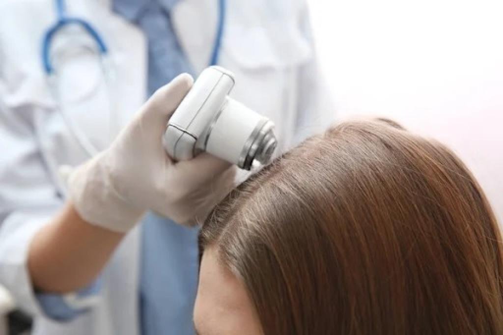 Comprehensive Insight into Hair Scalp Treatment in Singapore